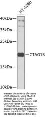 CTAG1B Antibody