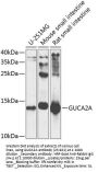 GUCA2A Antibody
