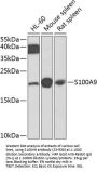 S100A9 Antibody