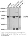 SLC2A2 Antibody
