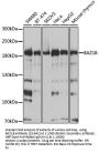 BAZ1B Antibody, KO Validated