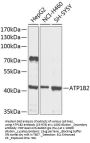 ATP1B2 Antibody