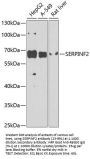 SERPINF2 Antibody