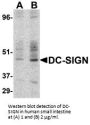 DC-SIGN Antibody