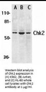 Chk2 Antibody
