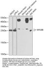 MYL6B Antibody