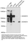 ADAM10 Antibody