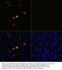 SARS-CoV-2 (COVID-19) Spike Antibody [ARC2373]