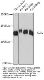 ACE2 Antibody, Monoclonal