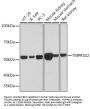 TMPRSS2 Antibody [ARC2373]
