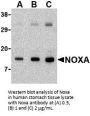 Noxa Antibody