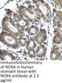 Noxa Antibody