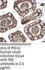 PID Antibody