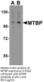MTBP Antibody