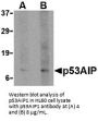 p53AIP1 Antibody