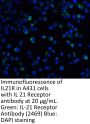 IL-21 Receptor Antibody