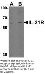 IL-21 Receptor Antibody