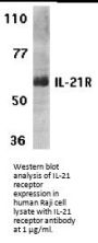 IL-21 Receptor Antibody