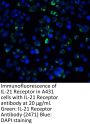 IL-21 Receptor Antibody