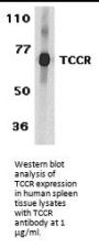TCCR Antibody