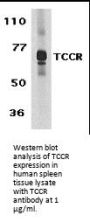 TCCR Antibody