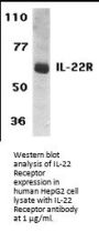 IL-22 Receptor Antibody