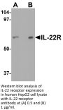 IL-22 Receptor Antibody