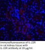 IL-22 Receptor Antibody