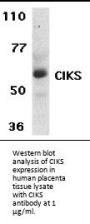 CIKS Antibody