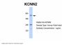 KCNN2 Antibody