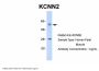 KCNN2 Antibody