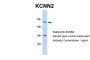 KCNN2 Antibody