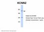 KCNN2 Antibody