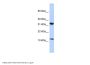 BTF3L1 Antibody