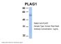 PLAG1 Antibody