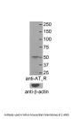 AGTR1 Antibody