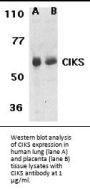 CIKS Antibody