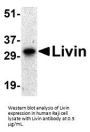 Livin Antibody