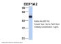 EEF1A2 Antibody