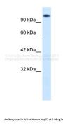 HIPK2 Antibody