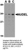 Nudel Antibody