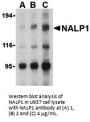 NALP1 Antibody