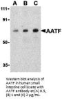 AATF Antibody