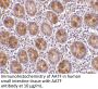 AATF Antibody