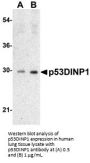p53DINP1 Antibody
