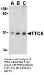 TTC5 Antibody