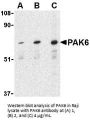 PAK6 Antibody