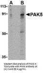 PAK5 Antibody