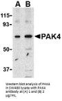PAK4 Antibody