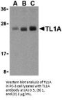 TL1A Antibody